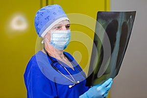 A surgeon in a surgical cap and a mask looking at an x-ray picture