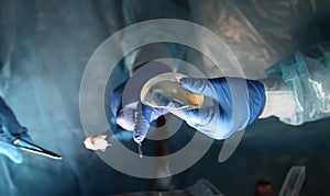 Surgeons hands holding breast implants and tools photo
