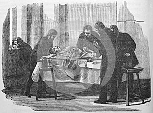 Surgeons perform an operation in the old book The Schools of Surgery, by A. Tauber, 1889, S.-Petersburg