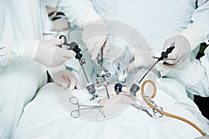 Surgeons team hands during laparoscopic abdominal operation in child surgery