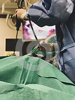 Surgeons using surgical instruments for keyhole surgery, watching the monitor which displays images from inside the patient`s abdo