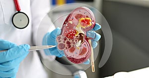 Surgery of kidneys and adrenal glands is medical surgical intervention