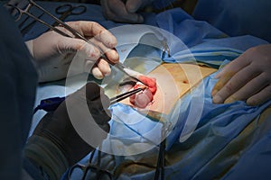 Surgical Area During The Surgery