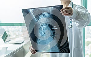 Surgical doctor looking at radiological spinal x-ray film for medical diagnosis on patientâ€™s health on spine disease