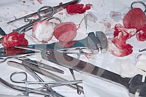 Surgical instruments, placed on the table after surgery