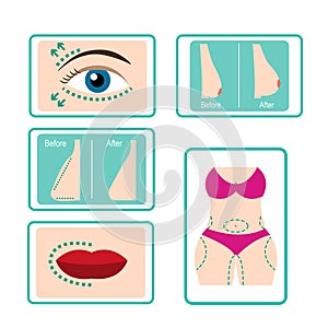 Plastic surgery icon set in flat style