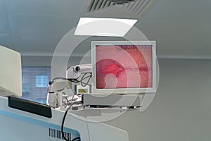 Surgical microscope in the operating room