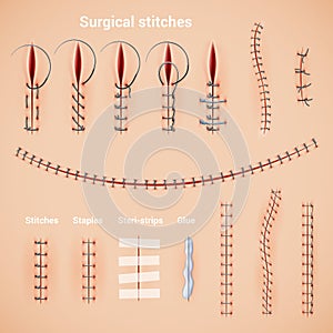 Surgical Stitches Infographic Set photo