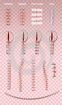 Surgical Suture Stitches Set