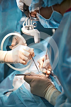 Surgical team in the operating room, close-up. An international team of professional doctors in a modern operating room