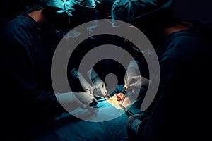 Surgical team performing surgery to patient in sterile operating room.