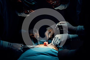 Surgical team performing surgery to patient in sterile operating room.