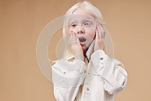 Surprised albino child with phone