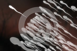 Swimming sperm