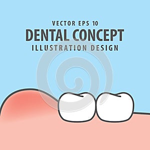 Swollen gums with teeth illustration vector on blue background.