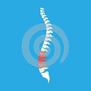 Symbolic image of red pain in intervertebral discs of spine