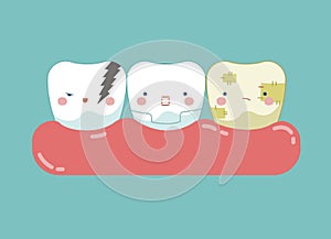 Symptom of dental ,teeth and tooth concept of dental photo