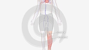 Symptomps of Deep vein thrombosis