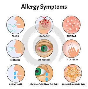 Symptoms of Allergies Skin rash, Allergic skin itching, Tearing from the eyes, Cough, Sneezing, Runny nose, Headache