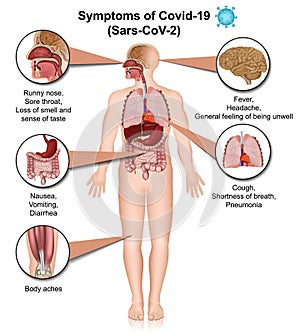 Symptoms of covid-19 infographic, coronavirus info isolated on white background