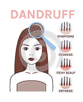 Symptoms of Dandruff. Woman with Problem Skin on Head. Analysis. Treatment. Magnifying glass and Close Up of Dryness and Redness.
