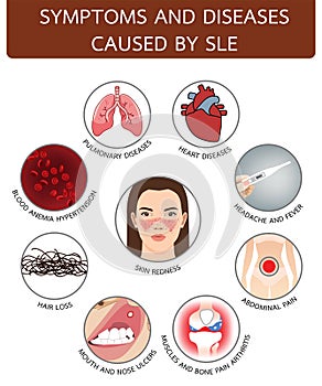 Symptoms and diseases caused by SLE, info graphic illustration on white background