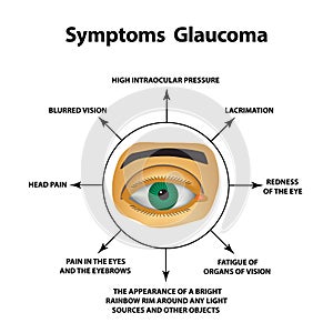 Symptoms of glaucoma. World glaucoma day. The anatomical structure of the eye. Infographics. Vector illustration on