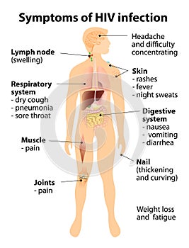 Symptoms of HIV infection