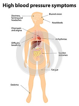 Symptoms of hypertension. high blood pressure photo