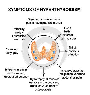 Symptoms of hyperthyroidism. Thyroid. Infographics.