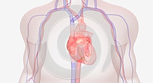 The Symptoms of Hypertrophic Cardiomyopathy