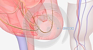 The Symptoms of Hypertrophic Cardiomyopathy