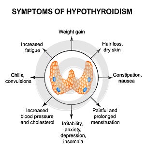 Symptoms of hypothyroidism. Thyroid. Infographics.