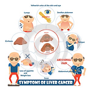 Symptoms of liver cancer