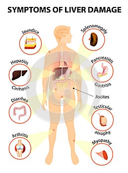 Symptoms Of Liver Disease photo