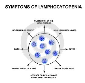 Symptoms of lymphocytopenia. Decreased lymphocytes in the blood. Infographics. Vector illustration on isolated