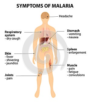 Symptoms of malaria