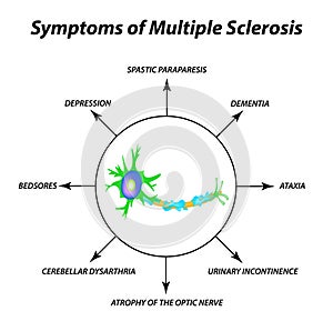 Symptoms of multiple sclerosis. The destruction of the myelin sheath on the axon. Damaged myelin. World Multiple