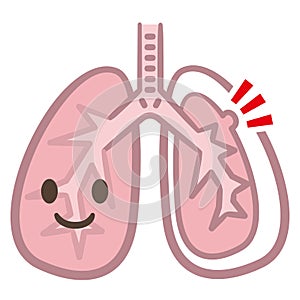 Symptoms of pneumothorax lung vector
