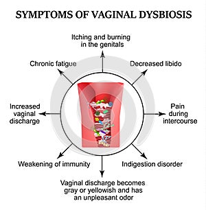 Symptoms of vaginal dysbiosis. Vaginitis, candidiasis. Patagene microflora of the vagina. Dysbacteriosis. Infographics.