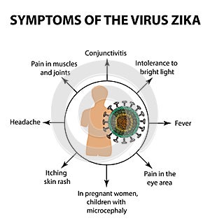 Symptoms of the virus Zika. Infographics. Vector illustration on isolated background photo
