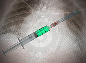 Syringe on X-ray