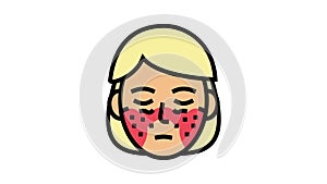 systemic lupus erythematosus color icon animation