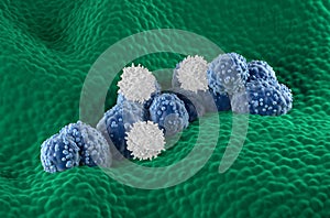 T-cells attack prostate cancer cells in the prostatic glandular epithelium - isometric view 3d illustration