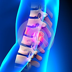 T10 Disc - Thoracic Spine Anatomy