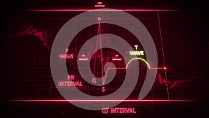 T Wave from Electrocardiogram Wave or ECG or EKG