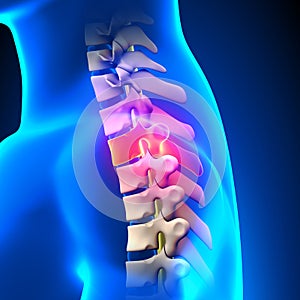 T2 Disc - Thoracic Spine Anatomy