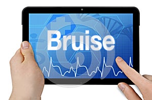 Tablet computer with bruise