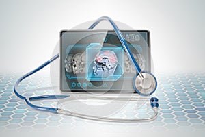 Tablet displaying brain scan