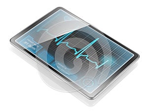 Tablet displaying ECG